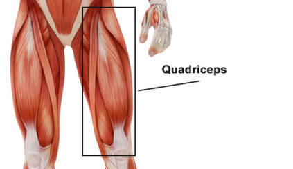 Quadriceps